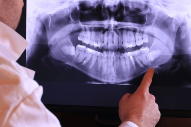 Best Emergency Treatment for Dental Infections or Abscesses in Bloomingdale, FL